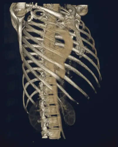 Animated 3D volume rendering of a CT scan in the ReadYourLab online DICOM viewer