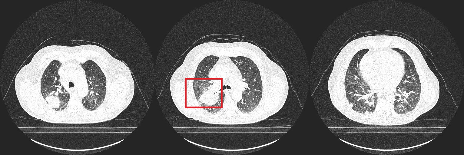Beispiel-CT-Scan-Bild