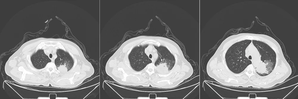 Sample CT scan image
